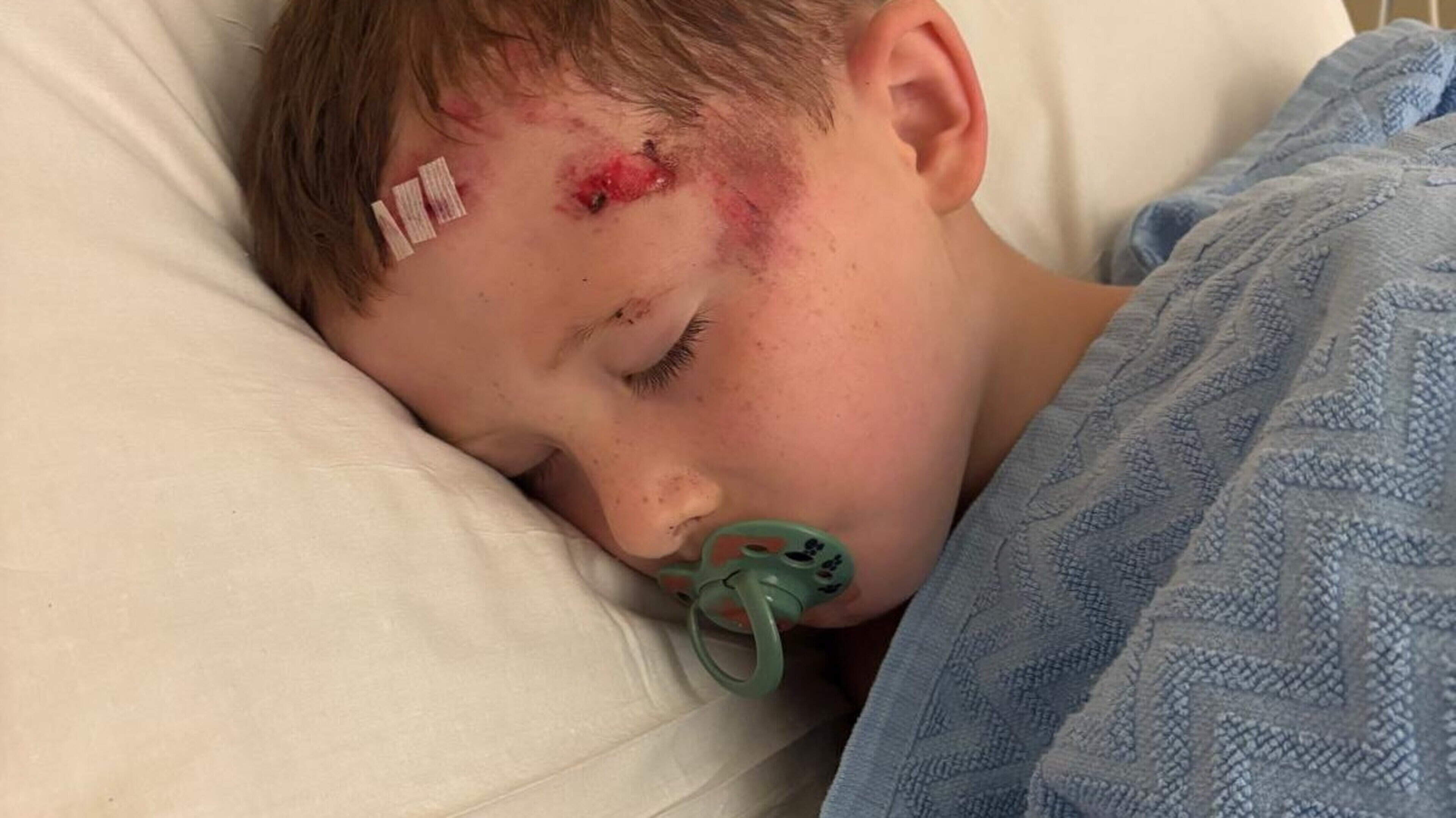 Mother Advocates E-Scooter Ban After Son's Injury