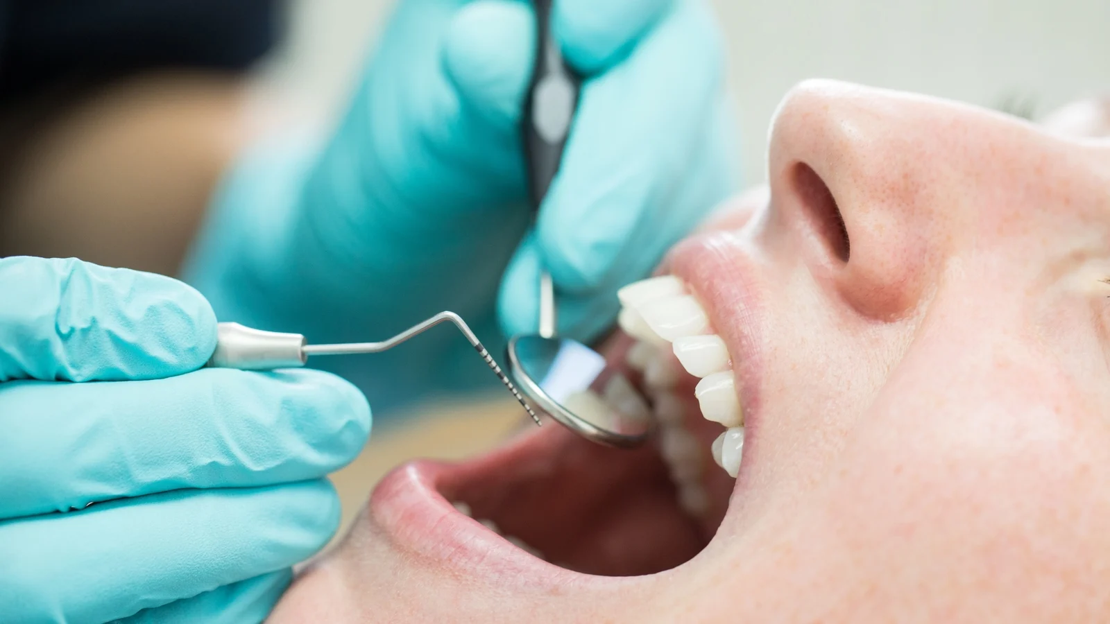 Dentist Participation in Medical Card Scheme Drops